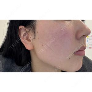 ルラ美容クリニック ルラ美容クリニック 静岡院口コミ