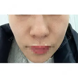 ビラビューティークリニック 博多美容外科/美容皮膚科 ビラビューティークリニック口コミ