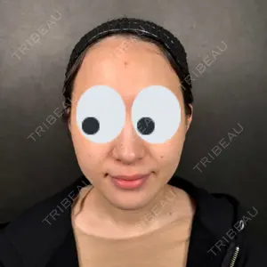 Nebula Clinic 新宿美容外科ネビュラクリニック口コミ