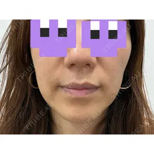 東京美容皮膚科アロエクリニック 東京美容皮膚科アロエクリニック池袋口コミ