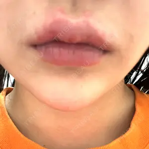 プロクリニック PRO CLINIC プロクリニック 銀座院口コミ