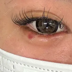 ルラ美容クリニック ルラ美容クリニック 横浜院口コミ