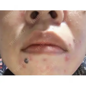 KMクリニック KM新宿クリニック口コミ