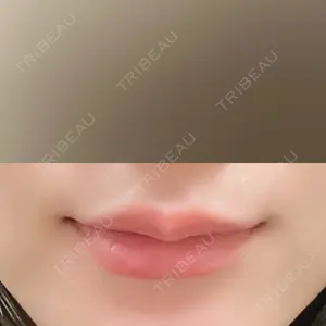 ルラ美容クリニック ルラ美容クリニック 大阪本院口コミ