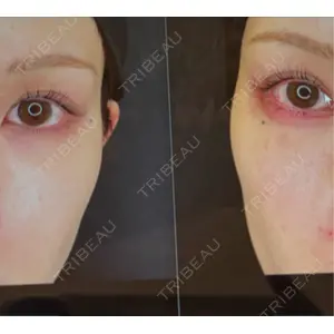 プロクリニック PRO CLINIC プロクリニック 銀座院口コミ