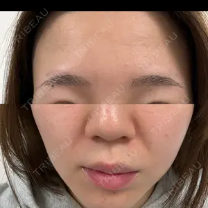 東京シルククリニック 東京シルククリニック 新宿院口コミ