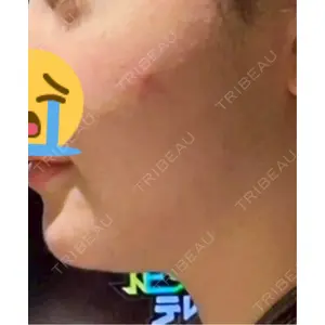 Chloe Cheongdam Clinic （クロエチョンダムクリニック）口コミ