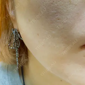 BITO BEAUTY CLINIC BITO BEAUTY CLINIC口コミ