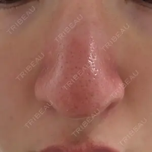 日本美容・医療クリニック 日本美容・医療クリニック 六本木院口コミ