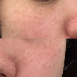 ルラ美容クリニック ルラ美容クリニック 札幌本院口コミ