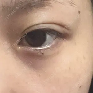 Nebula Clinic 新宿美容外科ネビュラクリニック口コミ