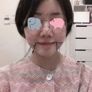 View美容整形外科口コミ