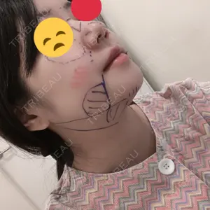 View美容整形外科口コミ