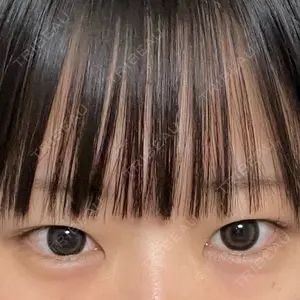 TCB東京中央美容外科 TCB東京中央美容外科 名古屋栄院口コミ