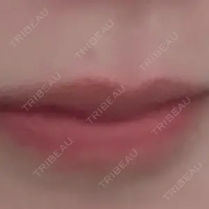 ルラ美容クリニック ルラ美容クリニック 大阪本院口コミ