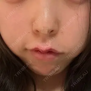 HAAB CLINIC HAAB BEAUTY CLINIC 名古屋院口コミ