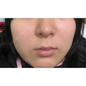 東京美容皮膚科アロエクリニック 東京美容皮膚科アロエクリニック池袋口コミ