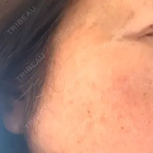 聖心美容クリニック グループ S-Laboクリニック 渋谷院口コミ