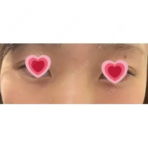 口コミ