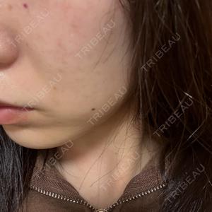ルラ美容クリニック ルラ美容クリニック 静岡院口コミ