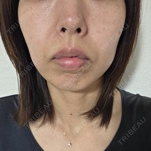東京シルククリニック 東京シルククリニック 新宿院口コミ