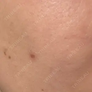 東京美容皮膚科アロエクリニック 東京美容皮膚科アロエクリニック池袋口コミ