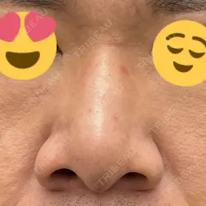 口コミ