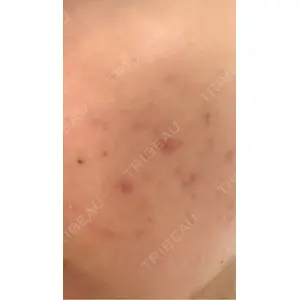 AURORA CLINIC（オーロラクリニック）新宿院口コミ