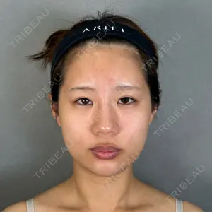 アリエル美容クリニック アリエル美容クリニック 大宮院口コミ