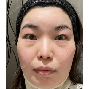 Nebula Clinic 新宿美容外科ネビュラクリニック口コミ