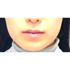 BiBiクリニック口コミ