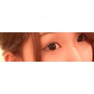 もとび美容外科クリニック 新宿院口コミ