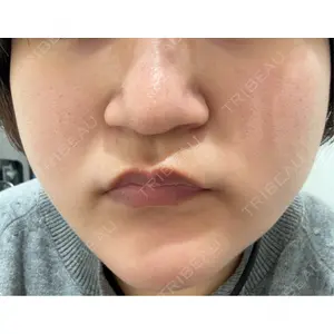 東京美容皮膚科アロエクリニック 東京美容皮膚科アロエクリニック池袋口コミ