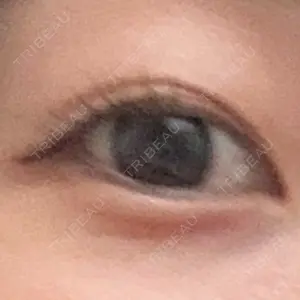フィラークリニック フィラークリニック 名古屋栄院口コミ