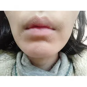 池袋美容クリニック 池袋美容クリニック口コミ