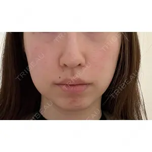 Fellez Clinic【フェルズクリニック】口コミ