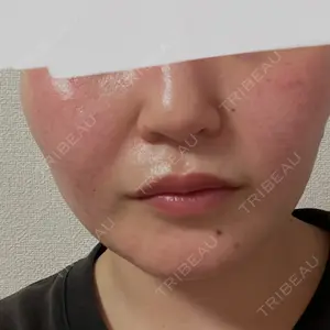 TCB東京中央美容外科 TCB東京中央美容外科 岡山院口コミ