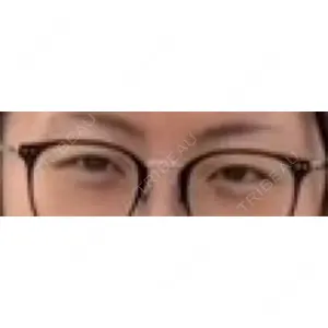 ヴィヴェンシアクリニック口コミ