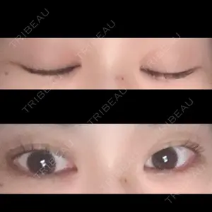 東京シンデレラ美容外科 東京シンデレラ美容外科 大宮院口コミ