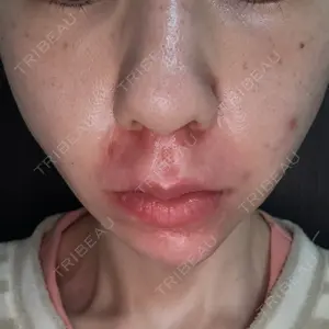 KARIS beauty clinic口コミ