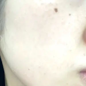 トラスト美容クリニック トラスト美容クリニック 銀座院口コミ