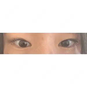 TCB東京中央美容外科 TCB東京中央美容外科 小倉院口コミ