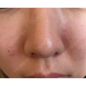 ルラ美容クリニック ルラ美容クリニック 仙台院 / ルラスキンクリニック 仙台院口コミ