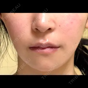 Nebula Clinic 新宿美容外科ネビュラクリニック口コミ