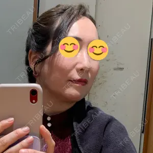 口コミ