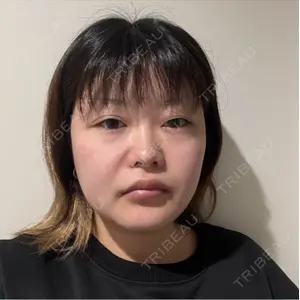 Nebula Clinic 新宿美容外科ネビュラクリニック口コミ