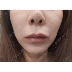 池袋美容クリニック 池袋美容クリニック口コミ