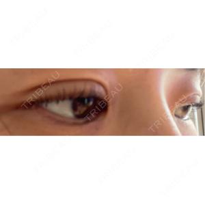 BITO BEAUTY CLINIC BITO BEAUTY CLINIC口コミ