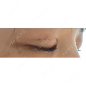 BITO BEAUTY CLINIC BITO BEAUTY CLINIC口コミ