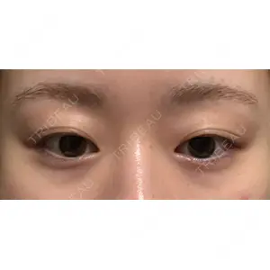 HAAB CLINIC HAAB×DREAM BEAUTY CLINIC 東京本院口コミ